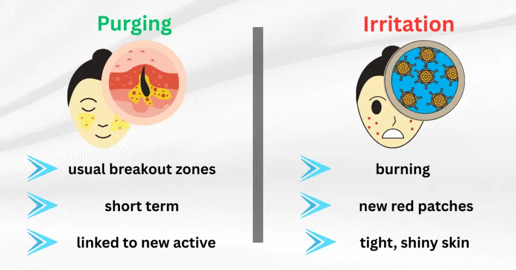 Purging vs irritation comparison infographic showing the difference between normal breakouts and skin damage from salicylic acid and retinol.